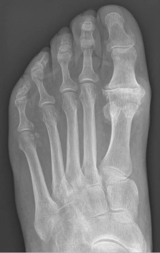 Bone & joint disease radiograph for self-assessment