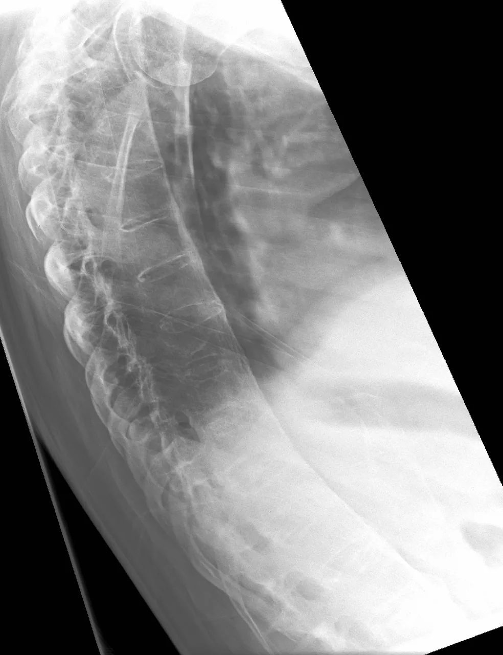 Spine radiograph for self-assessment