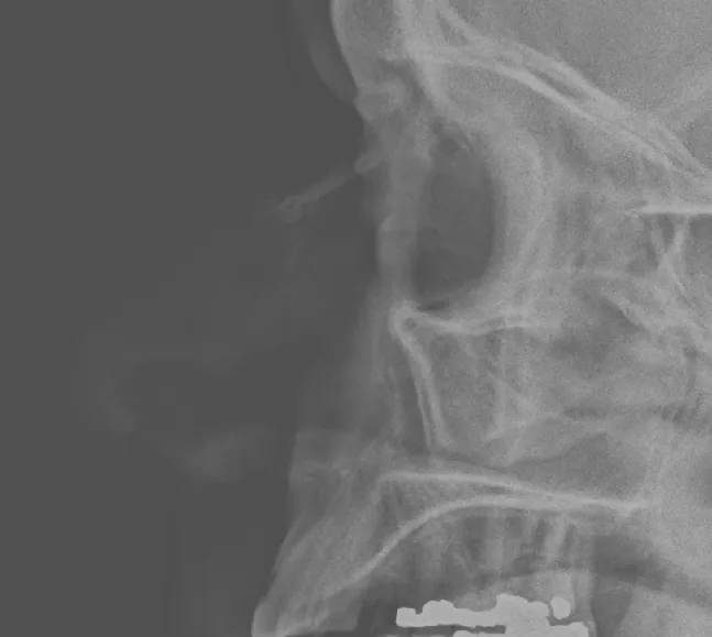Skull & face radiograph for self-assessment