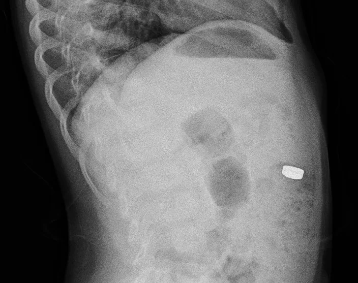 Abdomen radiograph for self-assessment