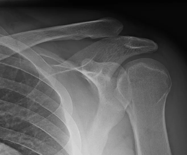 Upper limb radiograph for self-assessment