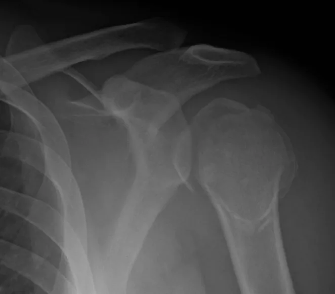 Upper limb radiograph for self-assessment