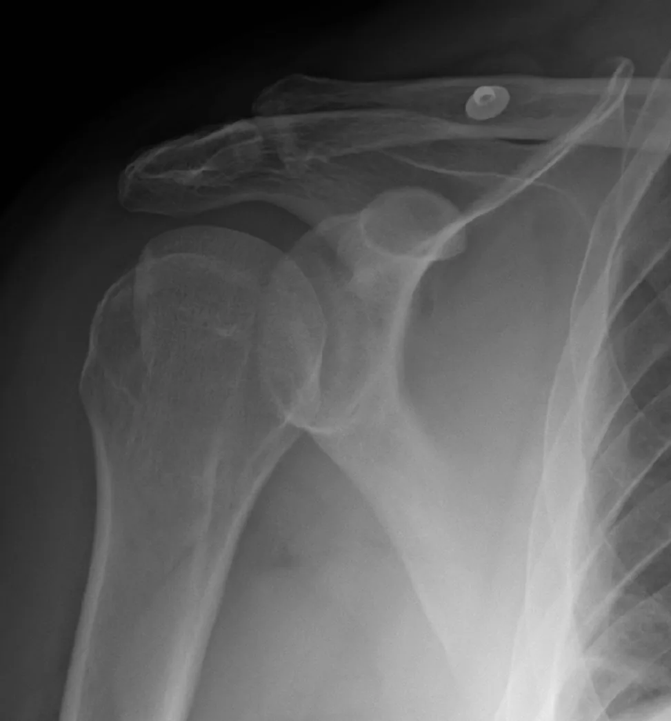 Upper limb radiograph for self-assessment