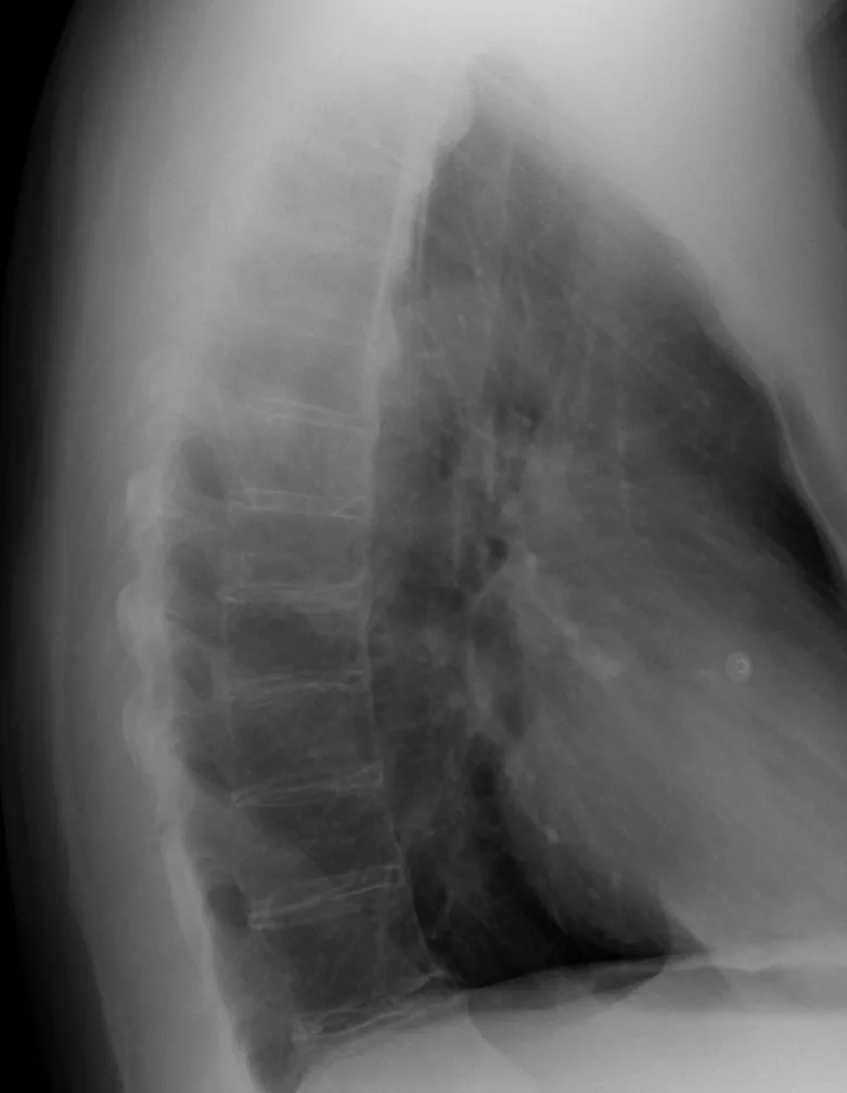 Spine radiograph for self-assessment