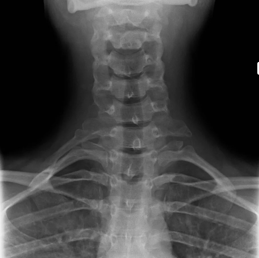Chest radiograph for self-assessment