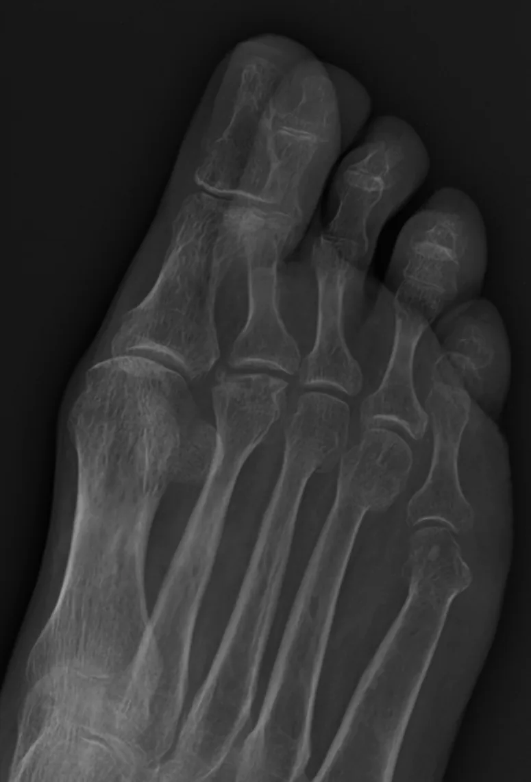 Bone & joint disease radiograph for self-assessment
