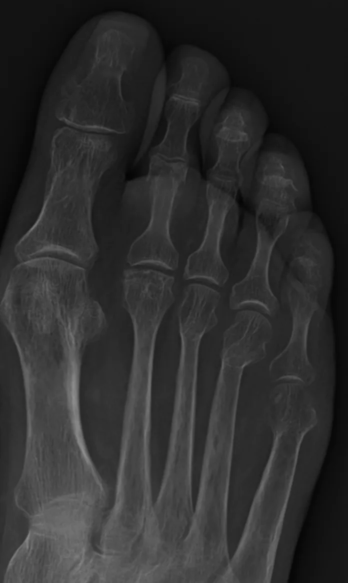 Bone & joint disease radiograph for self-assessment