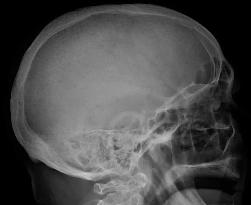 Bone & joint disease radiograph for self-assessment