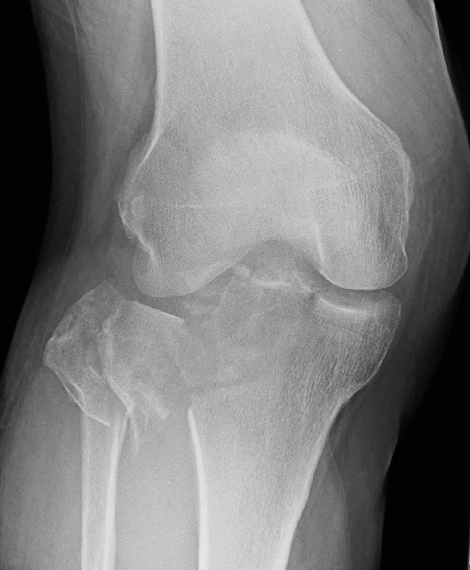 Lower limb radiograph for self-assessment