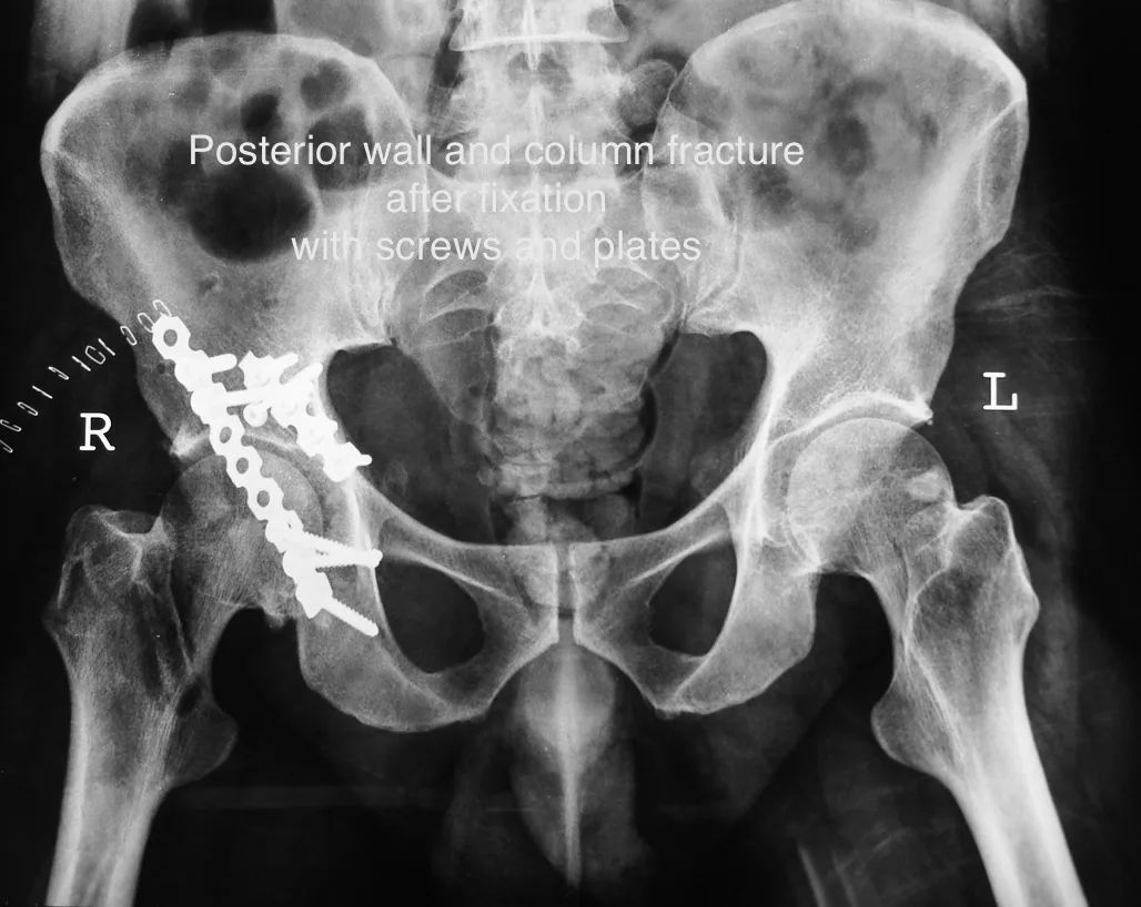 Lower limb radiograph for self-assessment