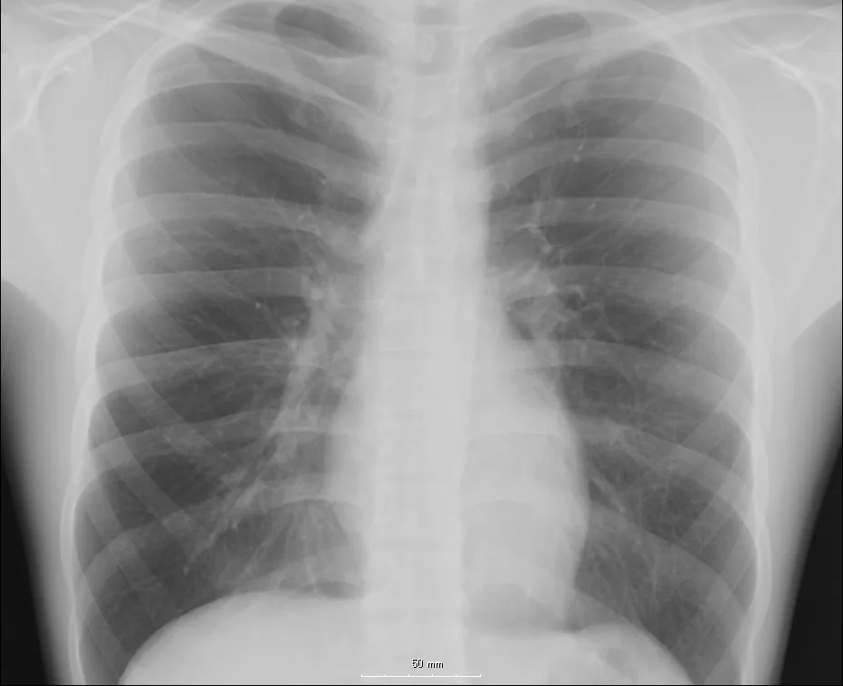 Chest radiograph for self-assessment