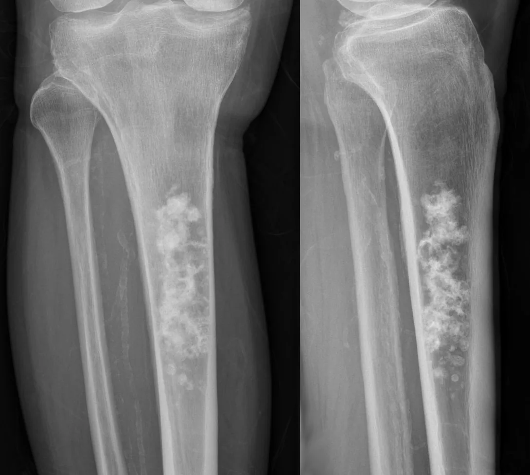Bone & joint disease radiograph for self-assessment