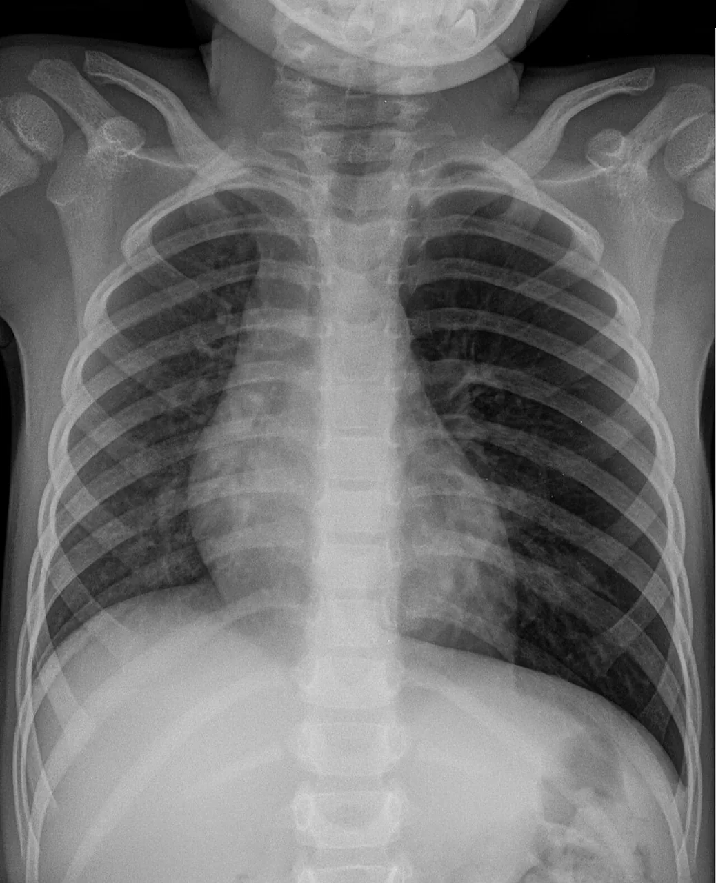 Paediatric radiograph for self-assessment