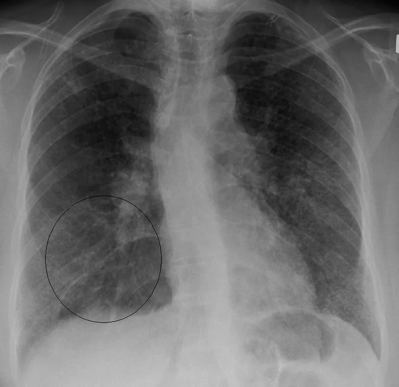 Chest radiograph for self-assessment