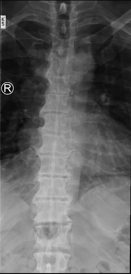 Spine radiograph for self-assessment