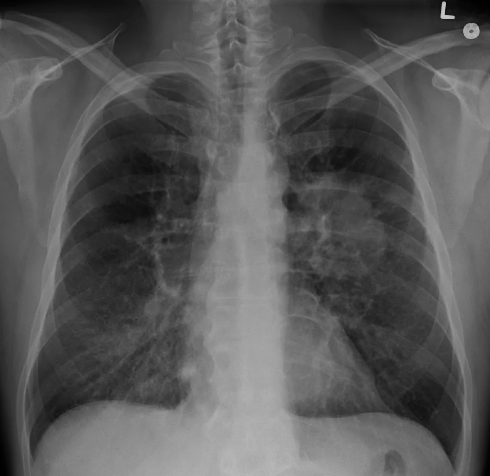 Chest radiograph for self-assessment
