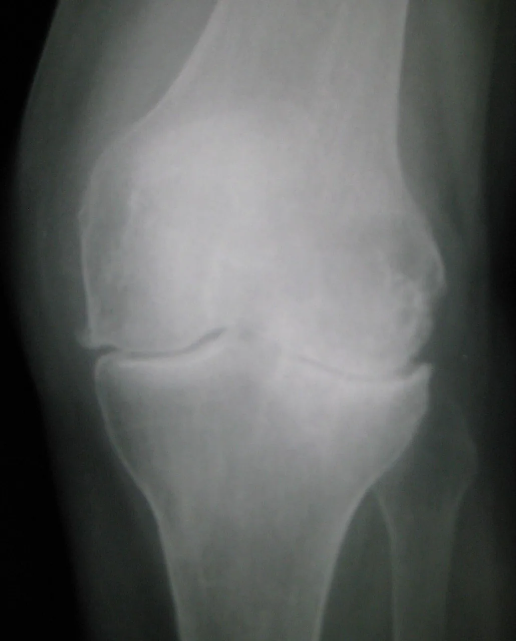 Bone & joint disease radiograph for self-assessment