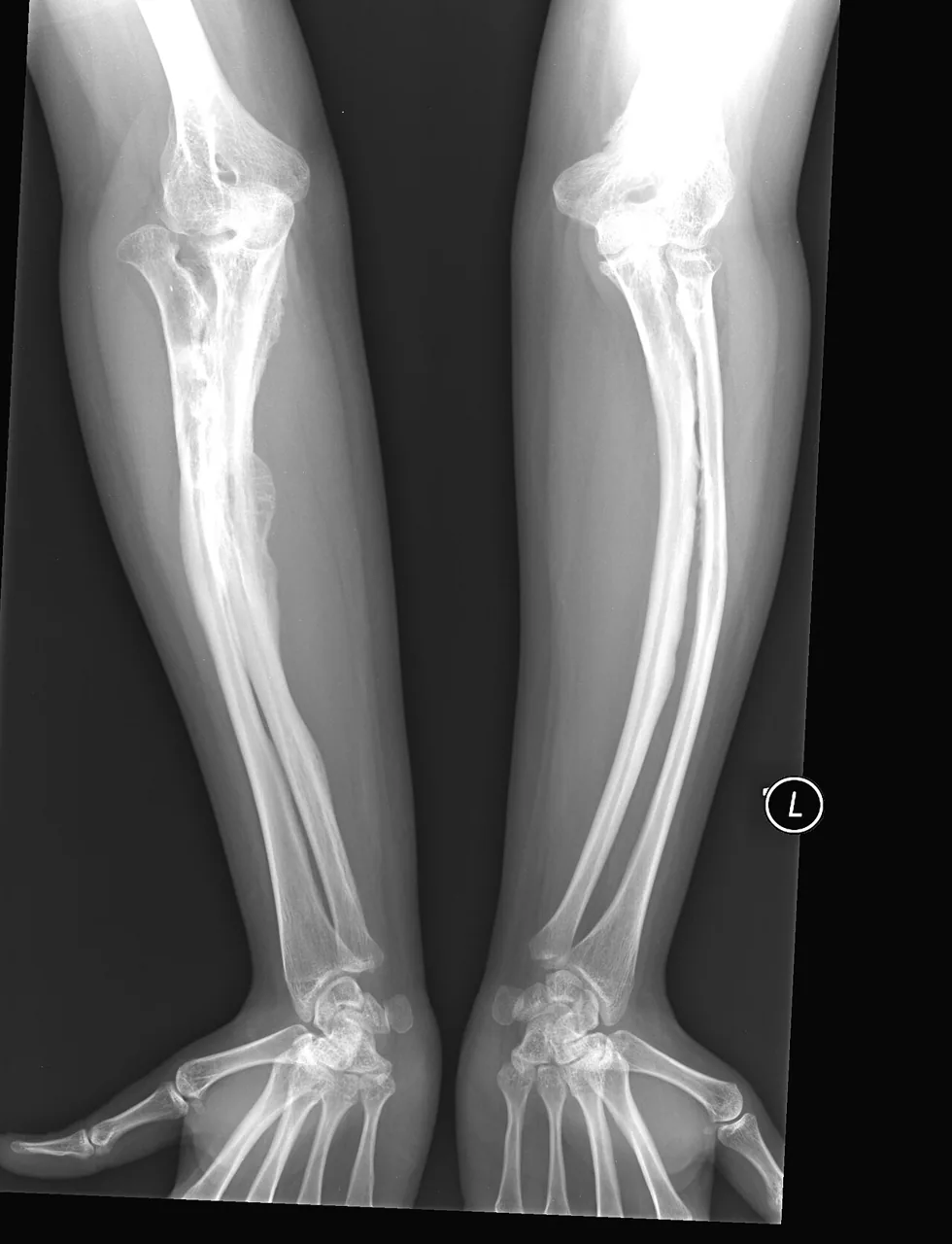 Paediatric radiograph for self-assessment