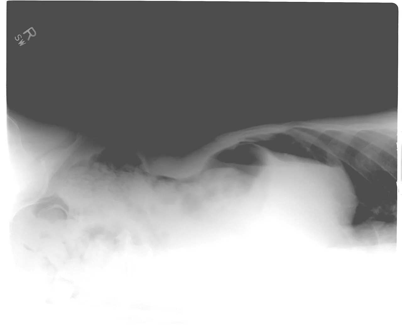 Abdomen radiograph for self-assessment
