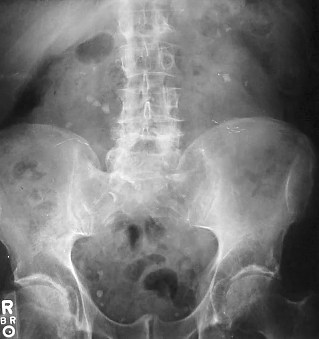 Abdomen radiograph for self-assessment