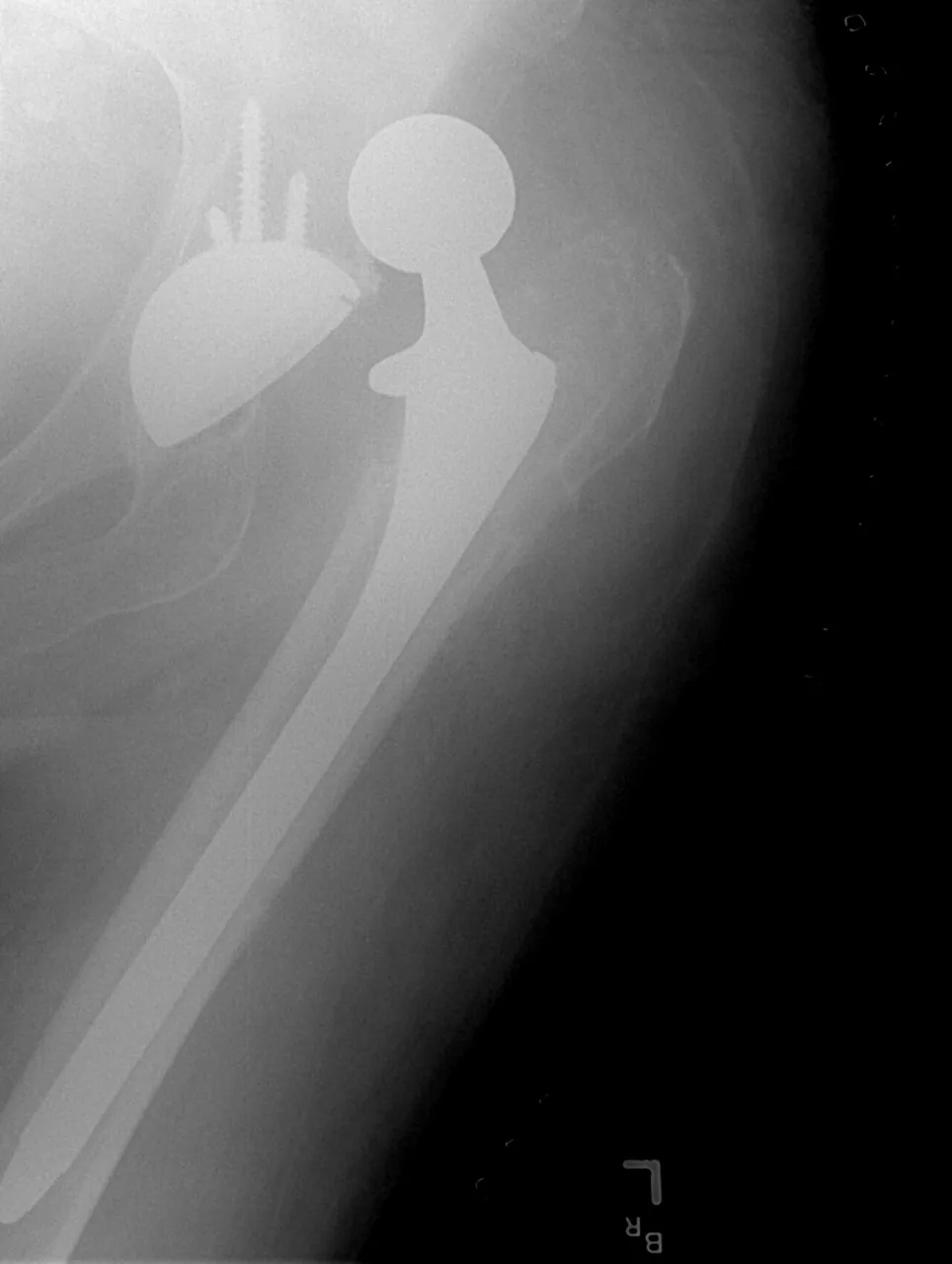 Lower limb radiograph for self-assessment