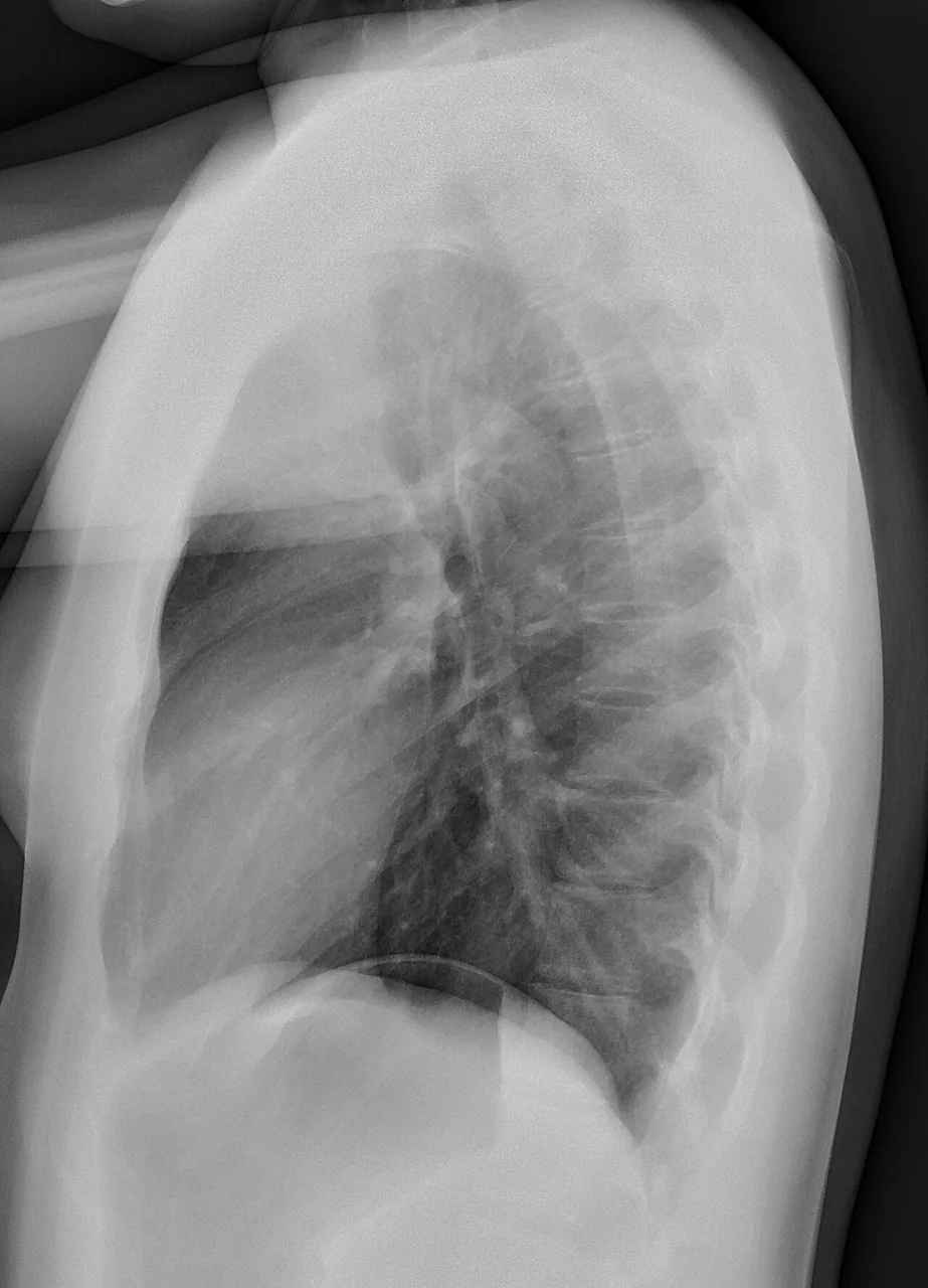 Chest radiograph for self-assessment