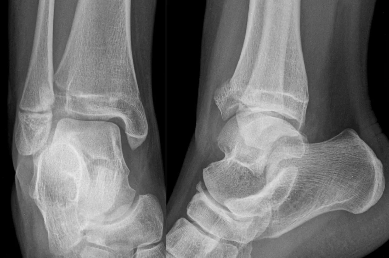 Lower limb radiograph for self-assessment