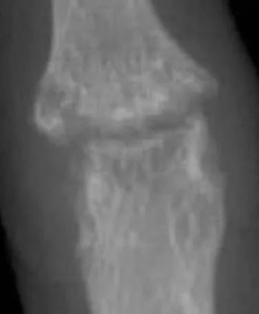 Bone & joint disease radiograph for self-assessment