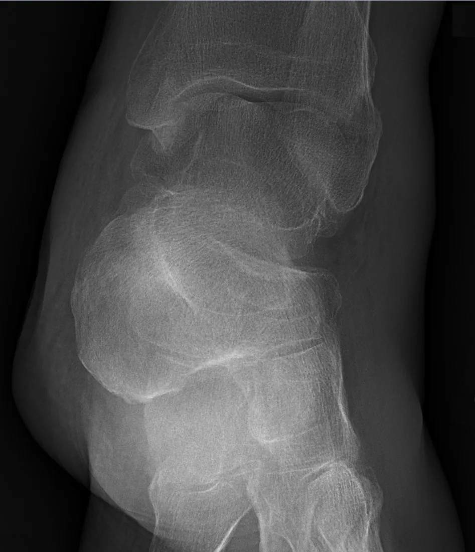 Lower limb radiograph for self-assessment