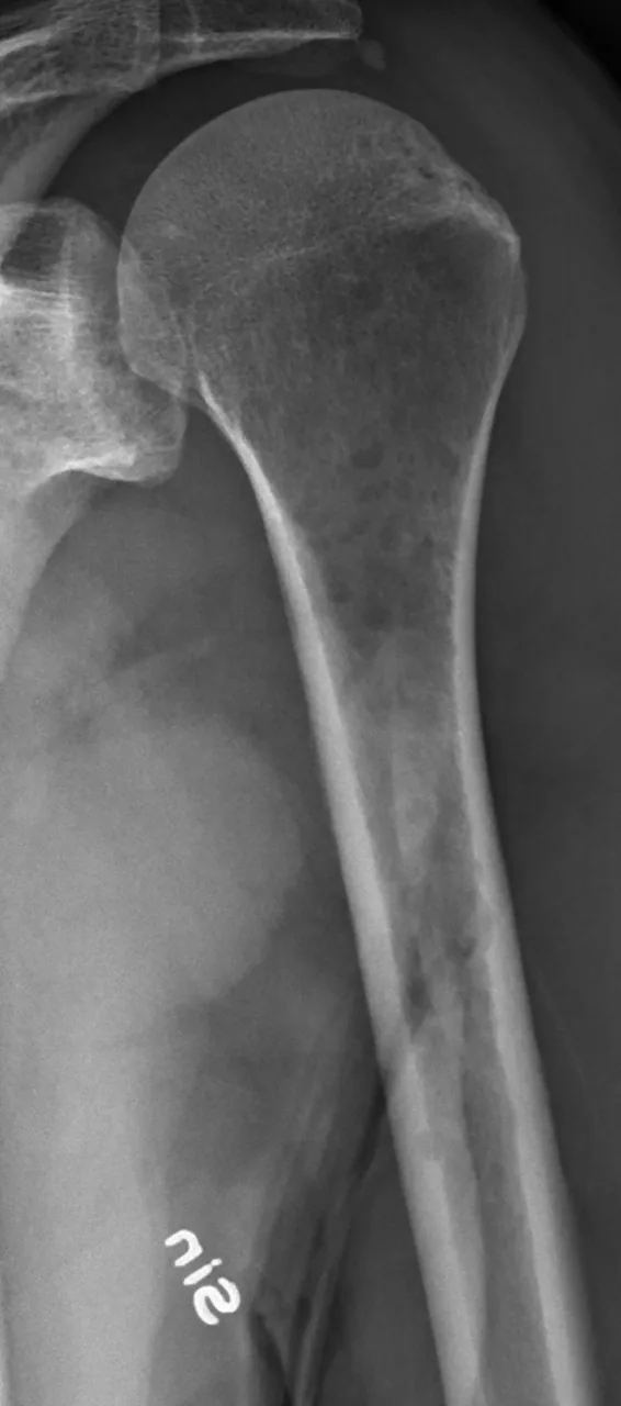 Bone & joint disease radiograph for self-assessment