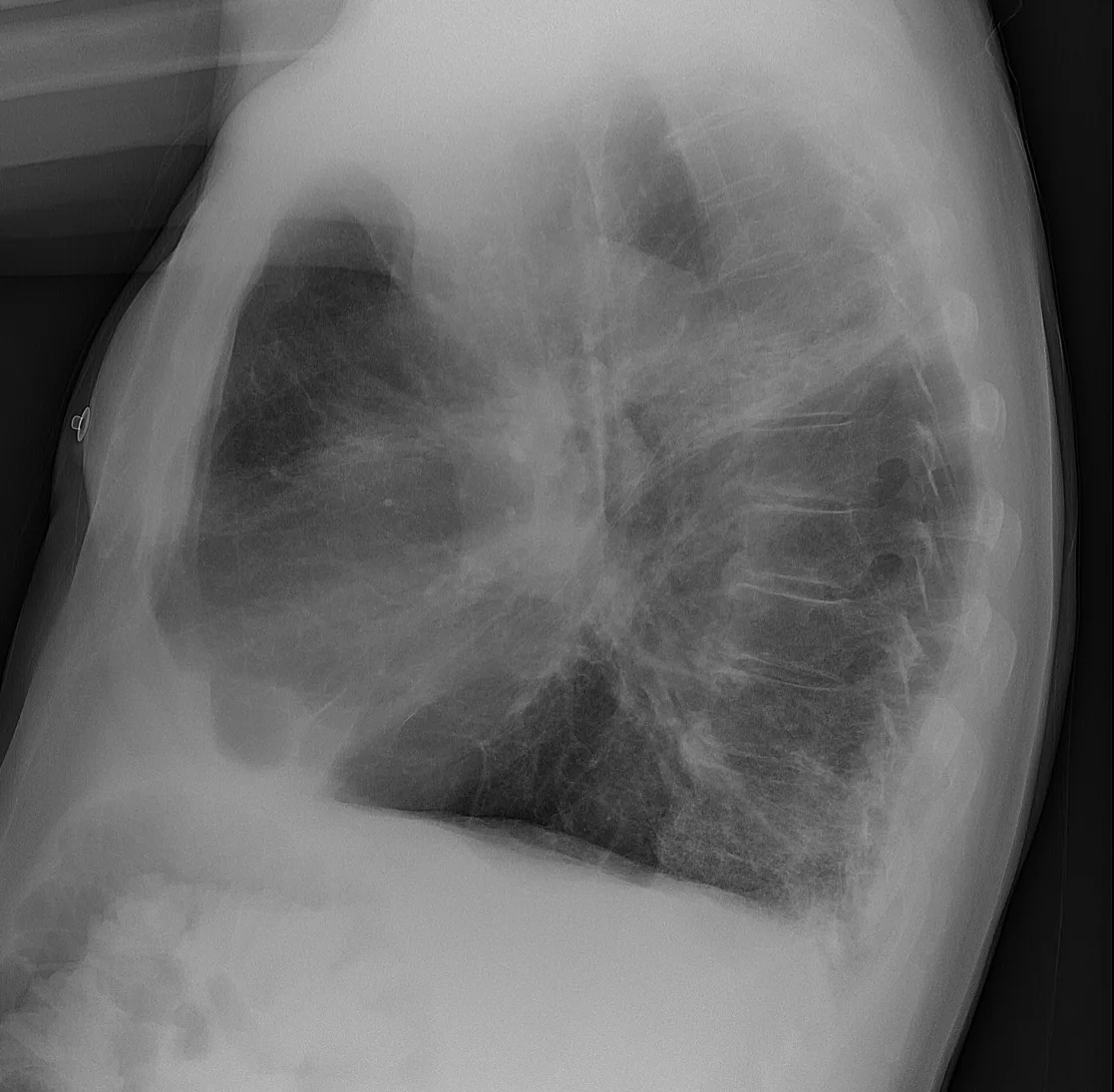 Chest radiograph for self-assessment