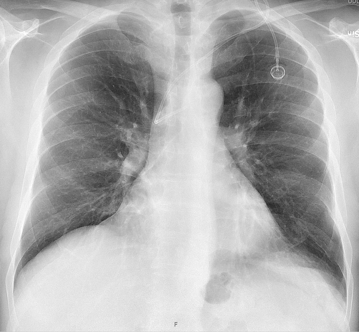 Lines & tubes radiograph for self-assessment