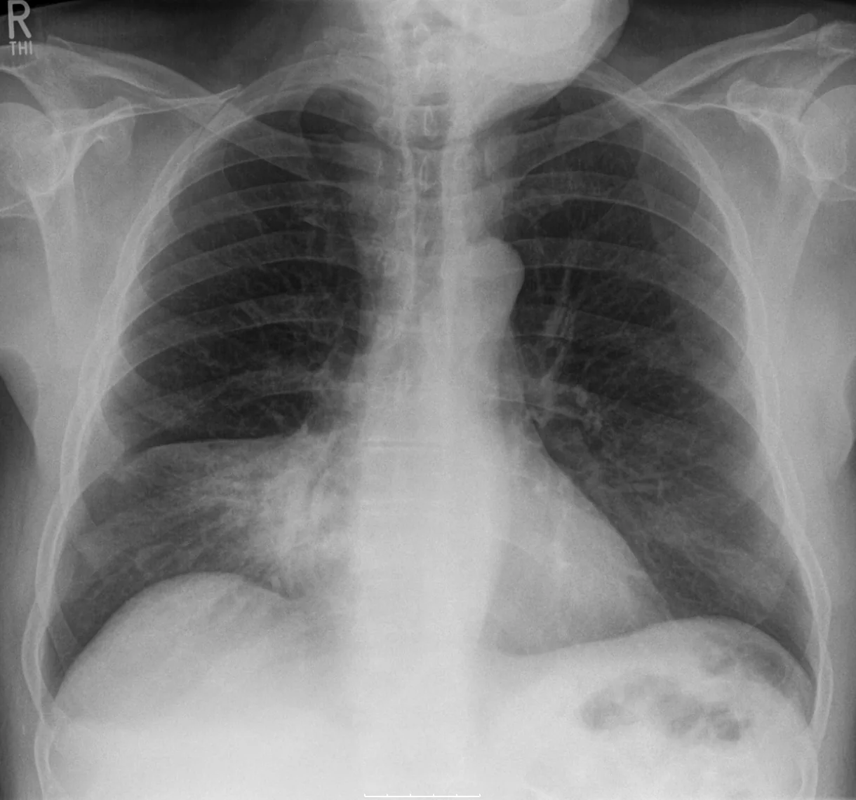 Chest radiograph for self-assessment