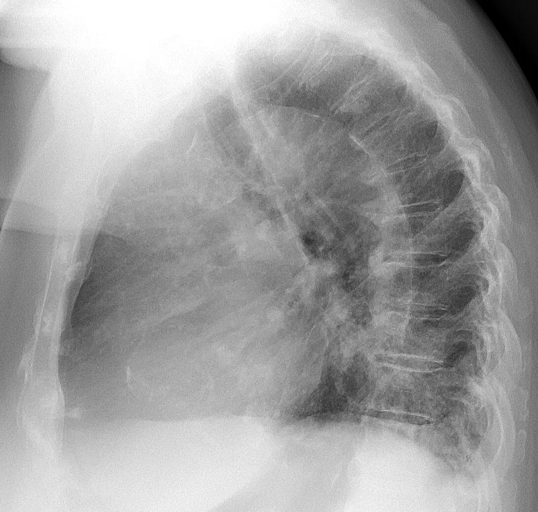 Chest radiograph for self-assessment