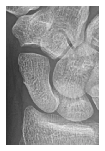 Upper limb radiograph for self-assessment