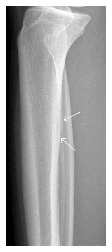 Lower limb radiograph for self-assessment