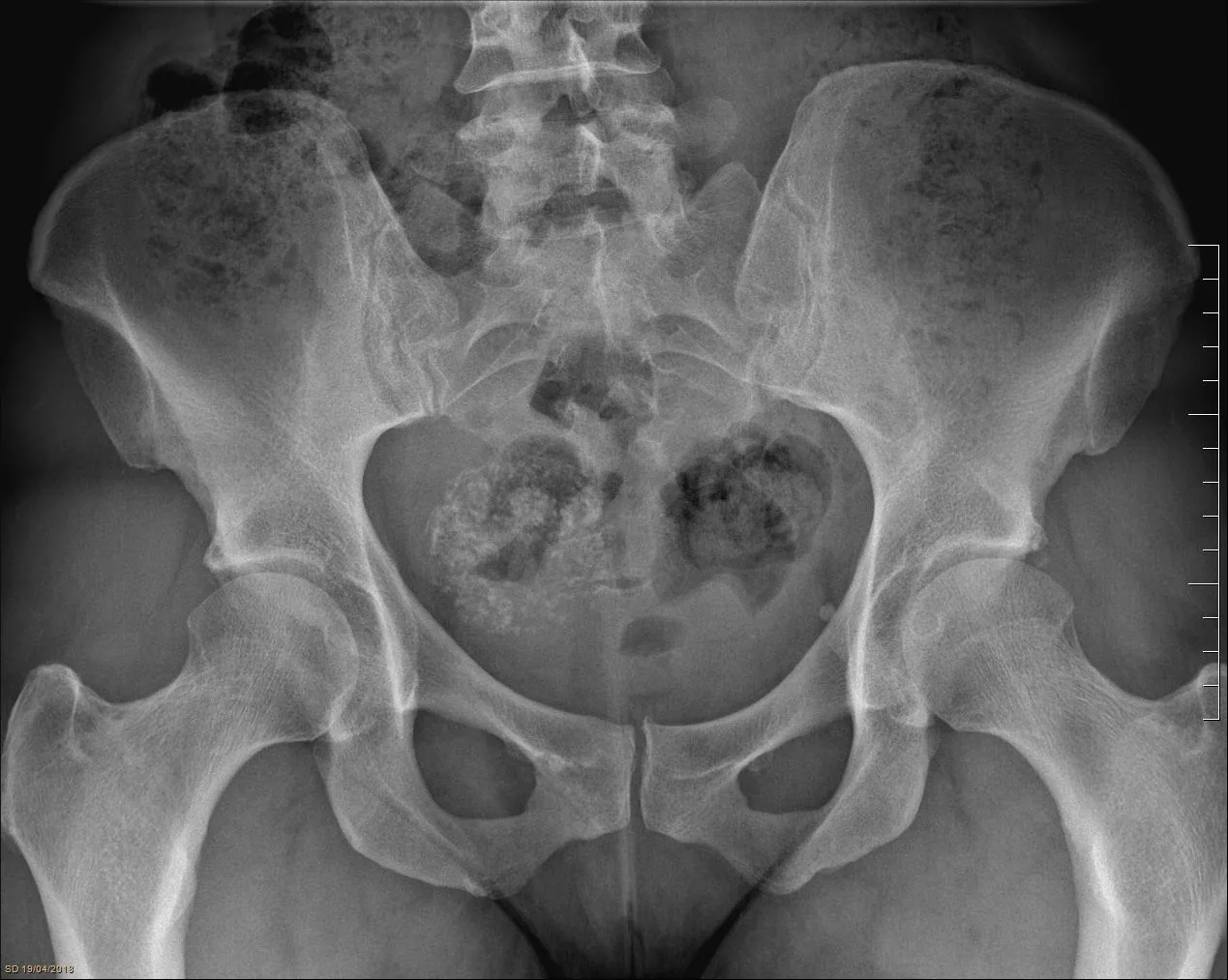 Abdomen radiograph for self-assessment