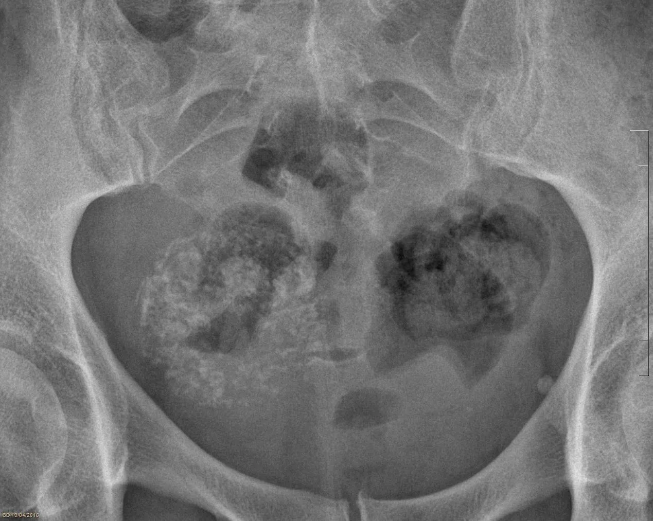 Abdomen radiograph for self-assessment