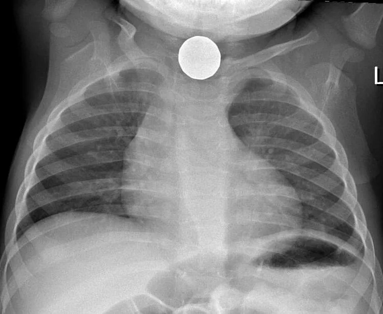 Paediatric radiograph for self-assessment