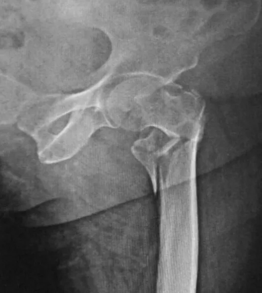 Lower limb radiograph for self-assessment