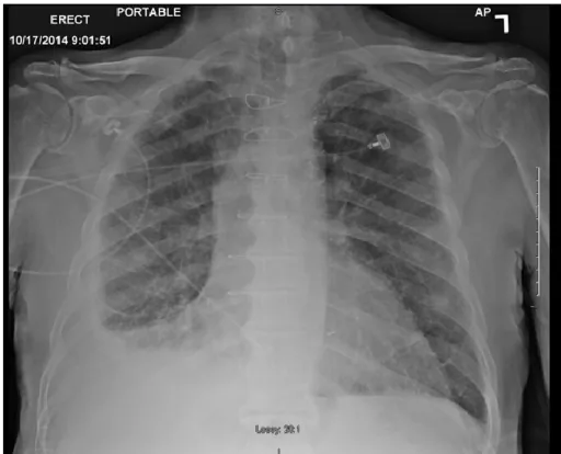 Chest radiograph for self-assessment