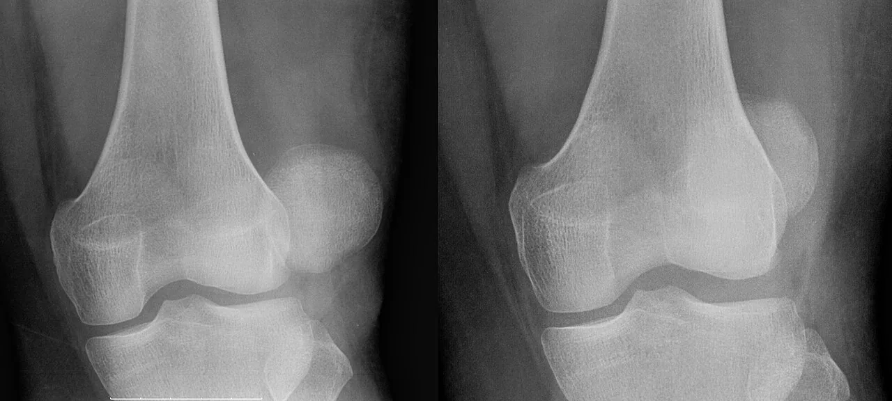 Lower limb radiograph for self-assessment