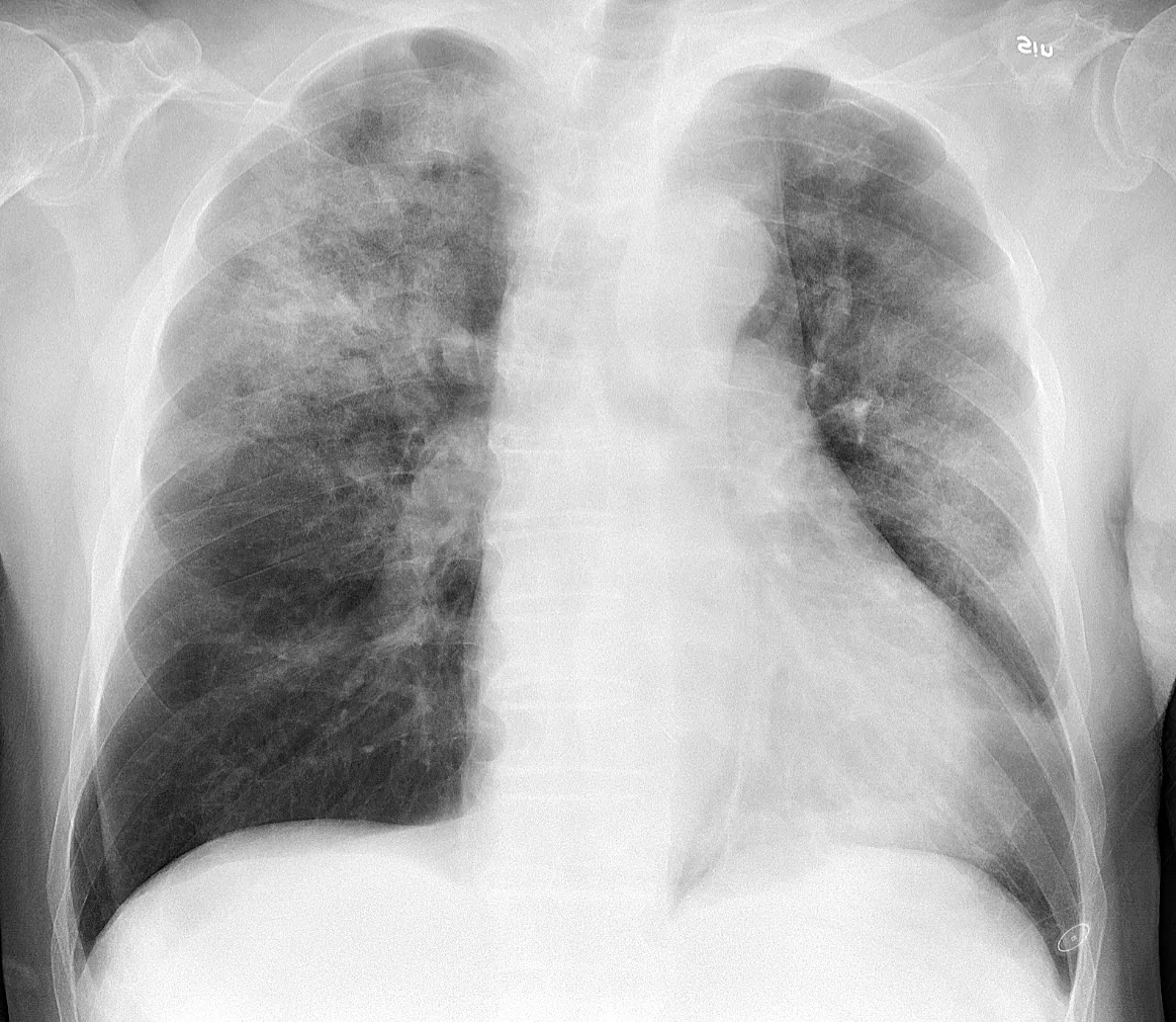 Chest radiograph for self-assessment