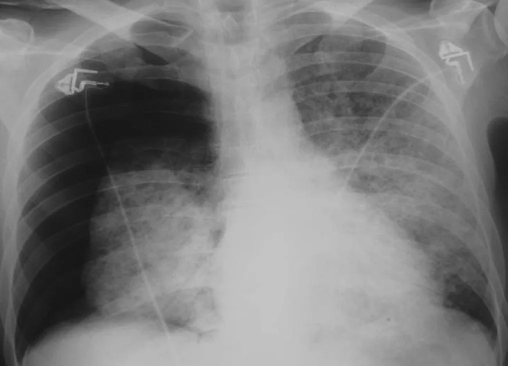 Chest radiograph for self-assessment