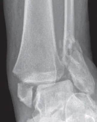 Lower limb radiograph for self-assessment