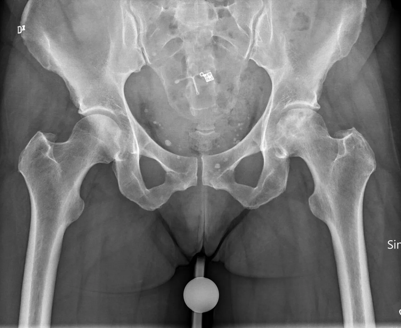 Bone & joint disease radiograph for self-assessment