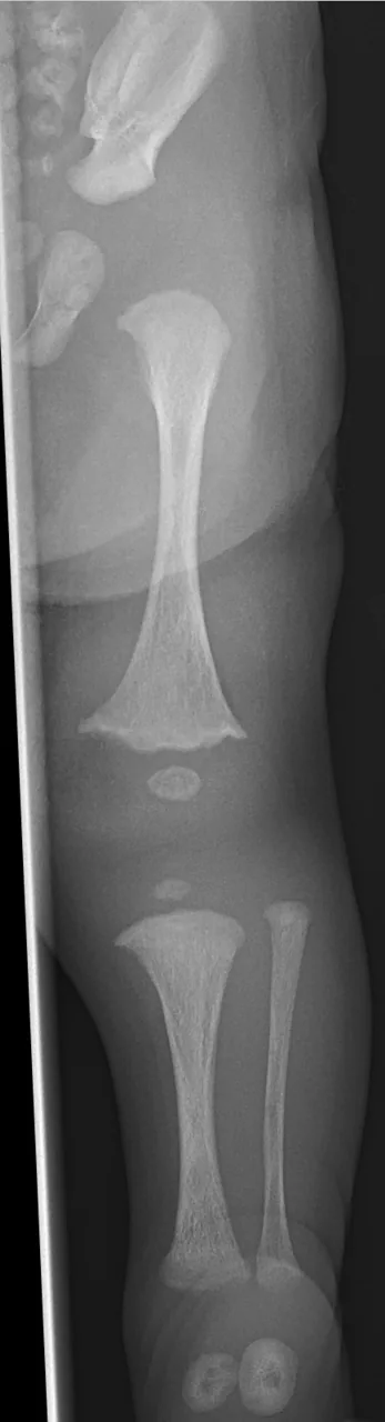 Paediatric radiograph for self-assessment