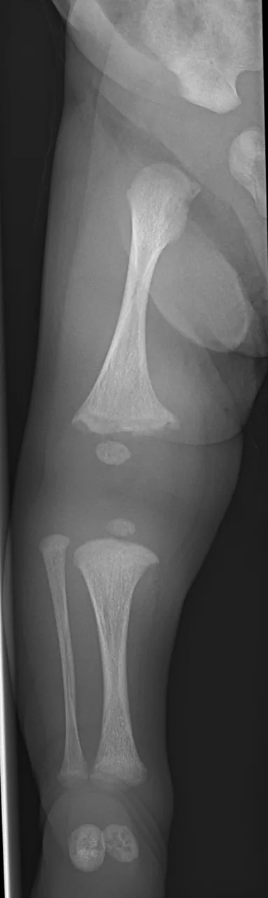 Paediatric radiograph for self-assessment