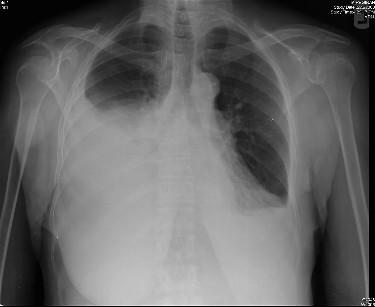 Chest radiograph for self-assessment