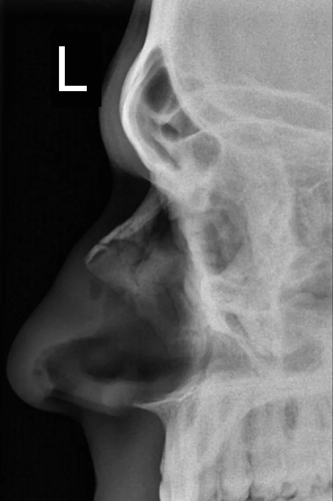 Skull & face radiograph for self-assessment